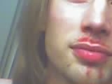 bloody.jpg
